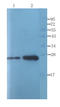 Alpha-1-acid glycoprotein antibody, orb339607, Biorbyt, Western Blot image 