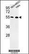 Egl-9 Family Hypoxia Inducible Factor 2 antibody, 63-600, ProSci, Western Blot image 