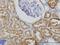Gamma-Butyrobetaine Hydroxylase 1 antibody, H00008424-M01, Novus Biologicals, Immunohistochemistry frozen image 