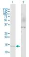 HBB antibody, H00003043-B01P, Novus Biologicals, Western Blot image 