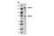 Spalt Like Transcription Factor 4 antibody, 5850S, Cell Signaling Technology, Western Blot image 