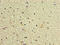 General Transcription Factor IIH Subunit 5 antibody, LS-C317761, Lifespan Biosciences, Immunohistochemistry paraffin image 