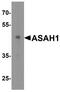 N-Acylsphingosine Amidohydrolase 1 antibody, NBP1-76933, Novus Biologicals, Western Blot image 