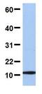 Ubiquitin-like protein FUBI antibody, GTX45390, GeneTex, Western Blot image 