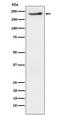 Erb-B2 Receptor Tyrosine Kinase 3 antibody, P00539, Boster Biological Technology, Western Blot image 