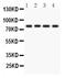 Protein Kinase C Eta antibody, PA5-79871, Invitrogen Antibodies, Western Blot image 