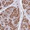 Coiled-Coil Domain Containing 58 antibody, NBP2-14452, Novus Biologicals, Immunohistochemistry paraffin image 
