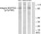Integrin Subunit Beta 3 antibody, LS-C117386, Lifespan Biosciences, Western Blot image 