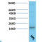 Transthyretin antibody, LS-C813251, Lifespan Biosciences, Western Blot image 