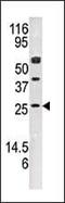 Adenylate Kinase 4 antibody, PA5-15426, Invitrogen Antibodies, Western Blot image 