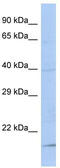 Family With Sequence Similarity 210 Member B antibody, TA342094, Origene, Western Blot image 