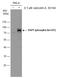 Yes Associated Protein 1 antibody, GTX130424, GeneTex, Western Blot image 