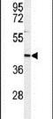 INO80 Complex Subunit B antibody, PA5-24764, Invitrogen Antibodies, Western Blot image 