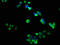 RELT TNF Receptor antibody, CSB-PA08179A0Rb, Cusabio, Immunofluorescence image 