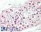 ETS Variant 5 antibody, LS-B10724, Lifespan Biosciences, Immunohistochemistry frozen image 