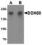 DExD/H-Box Helicase 60 antibody, GTX32082, GeneTex, Western Blot image 