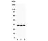 Potassium Voltage-Gated Channel Interacting Protein 3 antibody, R31396, NSJ Bioreagents, Western Blot image 