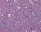 Treacle Ribosome Biogenesis Factor 1 antibody, orb96507, Biorbyt, Immunohistochemistry paraffin image 