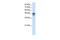 RNA Binding Motif Single Stranded Interacting Protein 3 antibody, GTX47421, GeneTex, Western Blot image 