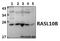 RAS Like Family 10 Member B antibody, A14239-1, Boster Biological Technology, Western Blot image 