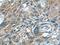 Kinase Insert Domain Receptor antibody, 26415-1-AP, Proteintech Group, Immunohistochemistry paraffin image 