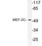 Myocyte Enhancer Factor 2C antibody, LS-C177798, Lifespan Biosciences, Western Blot image 