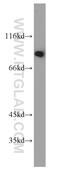 Thyroid Hormone Receptor Interactor 10 antibody, 10798-1-AP, Proteintech Group, Western Blot image 