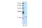 Mitochondrial RRNA Methyltransferase 1 antibody, A12144, Boster Biological Technology, Western Blot image 