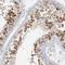 Cyclin Dependent Kinase 1 antibody, NBP1-85729, Novus Biologicals, Immunohistochemistry frozen image 