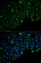 Hyaluronan Mediated Motility Receptor antibody, orb385448, Biorbyt, Immunocytochemistry image 