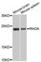 Ras Homolog Family Member A antibody, LS-C330888, Lifespan Biosciences, Western Blot image 