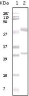 Estrogen Receptor 1 antibody, abx011649, Abbexa, Enzyme Linked Immunosorbent Assay image 