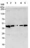 Actin Related Protein 2/3 Complex Subunit 1B antibody, ab99314, Abcam, Western Blot image 