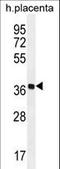 Olfactory Receptor Family 5 Subfamily AS Member 1 antibody, LS-C163228, Lifespan Biosciences, Western Blot image 