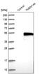Transmembrane Protein 143 antibody, PA5-53176, Invitrogen Antibodies, Western Blot image 