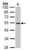 Protein-tyrosine kinase MPK-2 antibody, PA5-77926, Invitrogen Antibodies, Western Blot image 