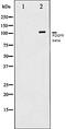 Platelet Derived Growth Factor Receptor Beta antibody, orb106355, Biorbyt, Western Blot image 