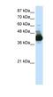 Ribonucleic Acid Export 1 antibody, NBP1-57187, Novus Biologicals, Western Blot image 