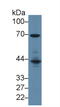 Lymphocyte Cytosolic Protein 2 antibody, MBS2026276, MyBioSource, Western Blot image 