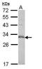 Tumor Protein P53 Inducible Nuclear Protein 1 antibody, GTX112066, GeneTex, Western Blot image 