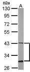 Ataxin 3 antibody, LS-C186388, Lifespan Biosciences, Western Blot image 