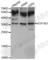 ATPase Na+/K+ Transporting Subunit Beta 1 antibody, A5793, ABclonal Technology, Western Blot image 