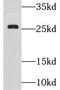 GS Homeobox 1 antibody, FNab03704, FineTest, Western Blot image 