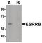 Estrogen Related Receptor Beta antibody, PA5-34362, Invitrogen Antibodies, Western Blot image 