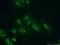 Protein Arginine Methyltransferase 1 antibody, 11279-1-AP, Proteintech Group, Immunofluorescence image 
