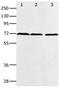 Protein Arginine Methyltransferase 5 antibody, orb107576, Biorbyt, Western Blot image 