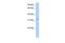 Nuclear Receptor Interacting Protein 2 antibody, PA5-43618, Invitrogen Antibodies, Western Blot image 