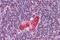 T Cell Leukemia Homeobox 1 antibody, GTX85867, GeneTex, Immunohistochemistry paraffin image 