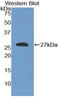 SHC Adaptor Protein 2 antibody, LS-C296400, Lifespan Biosciences, Western Blot image 