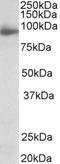 Neuroligin 4 X-Linked antibody, TA311492, Origene, Western Blot image 